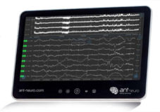 ANT Neuro NEO aEEG
