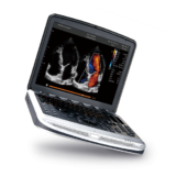 CHISON SonoBook 8